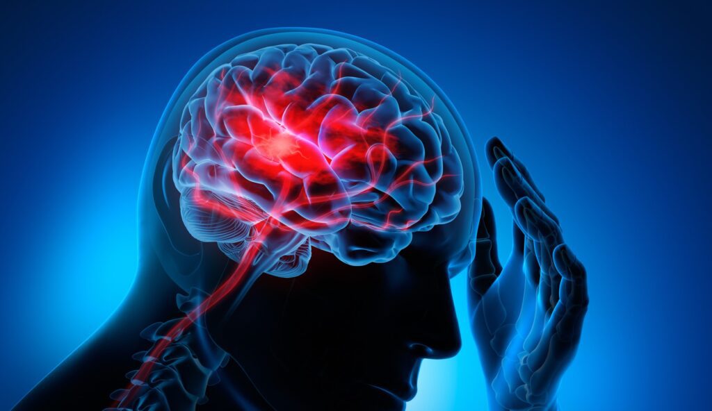 Man With Brain Stroke Symptoms