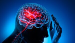 Man with brain stroke symptoms