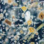 A close up of some microscopic organisms in water
